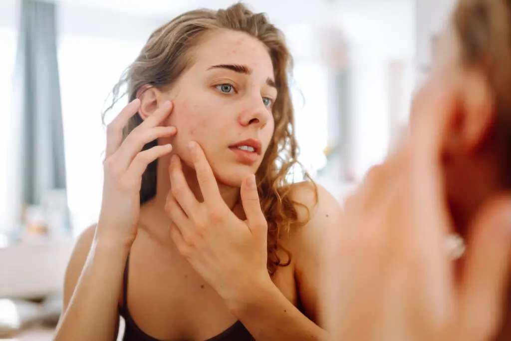 Woman examining acne in mirror